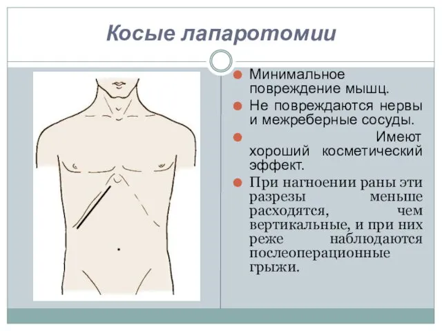 Косые лапаротомии Минимальное повреждение мышц. Не повреждаются нервы и межреберные