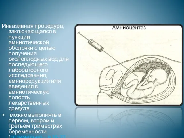 Инвазивная процедура, заключающаяся в пункции амниотической оболочки с целью получения