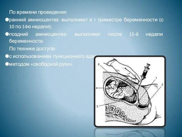 По времени проведения: ранний амниоцентез: выполняют в I триместре беременности