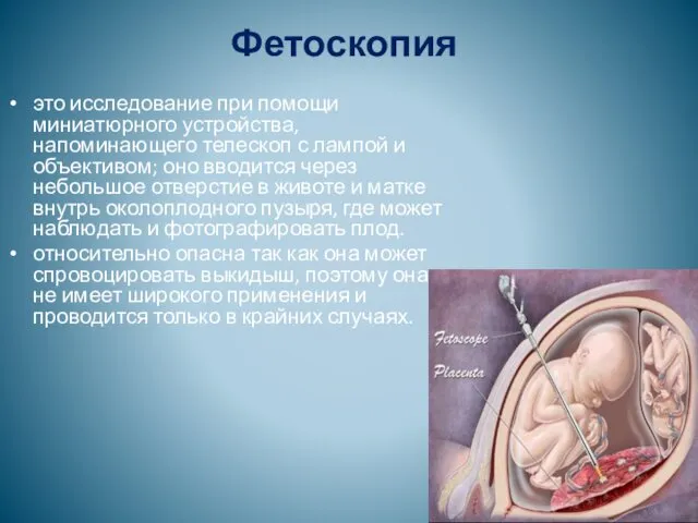 Фетоскопия это исследование при помощи миниатюрного устройства, напоминающего телескоп с