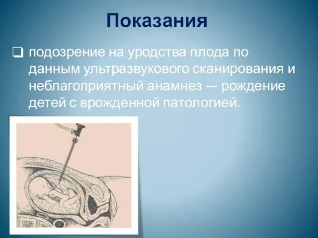 Показания подозрение на уродства плода по данным ультразвукового сканирования и