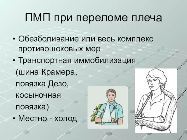 ПМП при переломе плеча Обезболивание или весь комплекс противошоковых мер