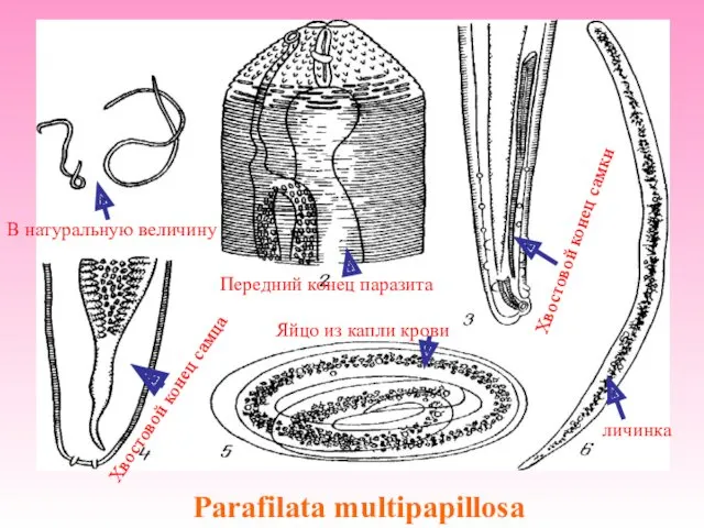 Parafilata multipapillosa В натуральную величину Передний конец паразита Хвостовой конец