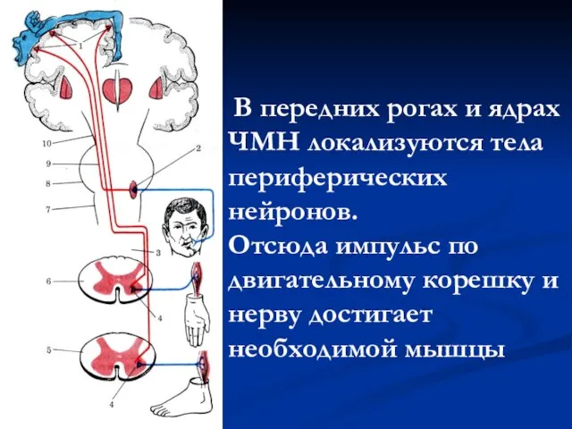 В передних рогах и ядрах ЧМН локализуются тела периферических нейронов.