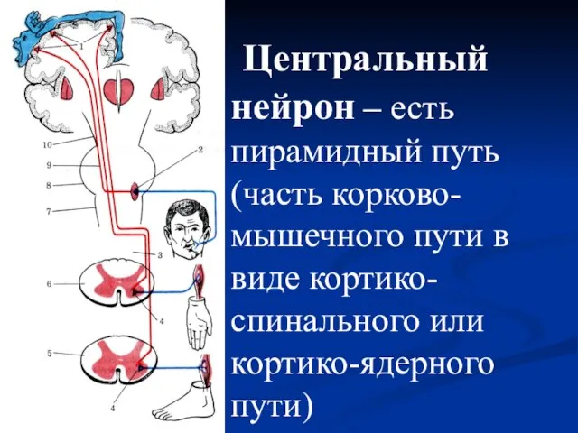 Центральный нейрон – есть пирамидный путь (часть корково-мышечного пути в виде кортико-спинального или кортико-ядерного пути)