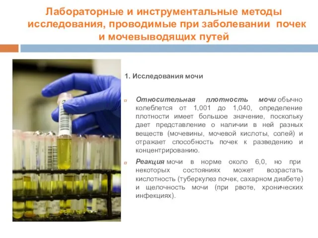 1. Исследования мочи Относительная плотность мочи обычно колеблется от 1,001