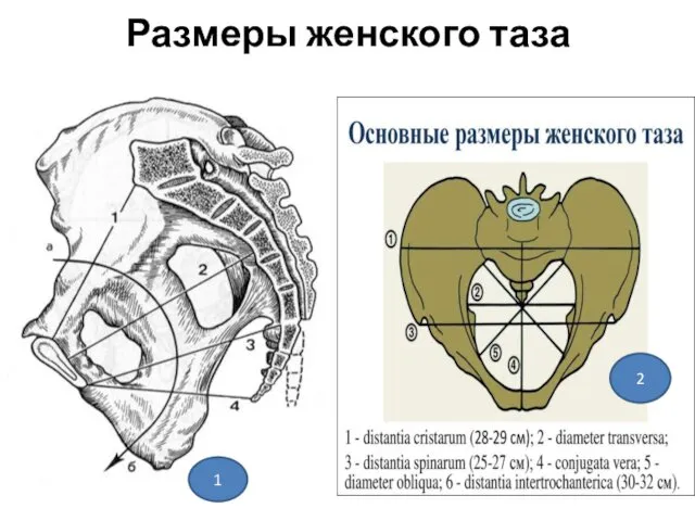 Размеры женского таза 1 2