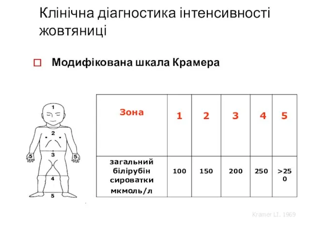 Клінічна діагностика інтенсивності жовтяниці Модифікована шкала Крамера Kramer LI. 1969