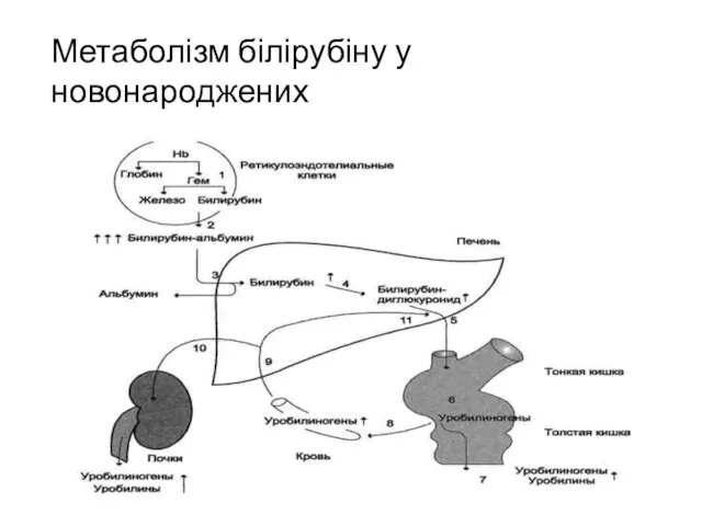 Метаболізм білірубіну у новонароджених