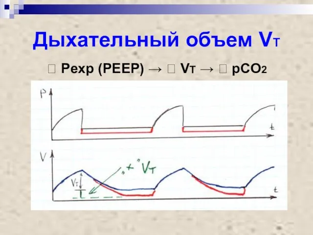 Дыхательный объем VT ? Pexp (PEEP) → ? VT → ? pCO2