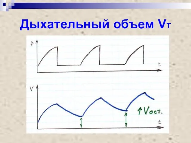 Дыхательный объем VT