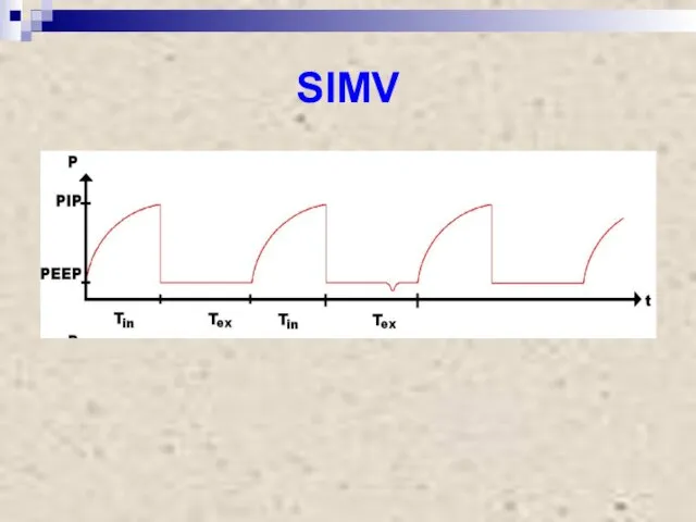 SIMV