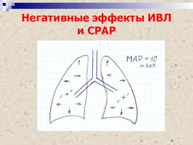 Негативные эффекты ИВЛ и СРАР