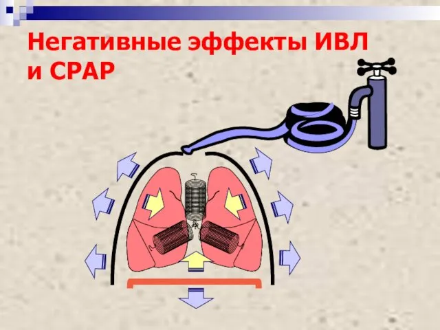 Негативные эффекты ИВЛ и СРАР