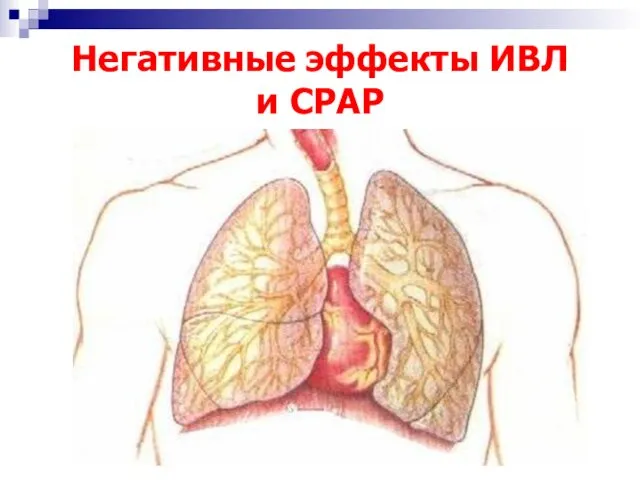 Негативные эффекты ИВЛ и СРАР