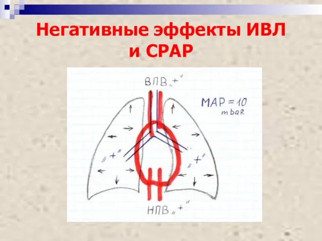 Негативные эффекты ИВЛ и СРАР