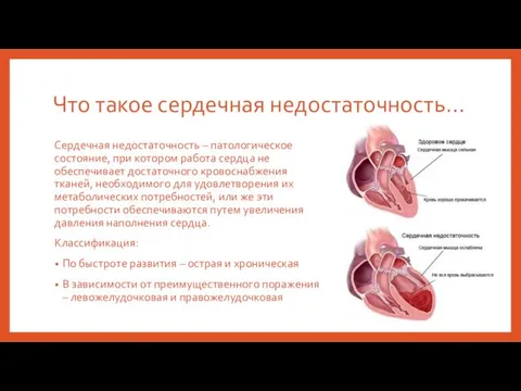 Что такое сердечная недостаточность… Сердечная недостаточность – патологическое состояние, при котором работа сердца