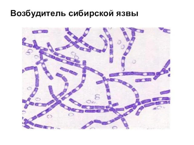 Возбудитель сибирской язвы