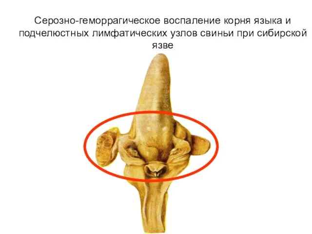 Серозно-геморрагическое воспаление корня языка и подчелюстных лимфатических узлов свиньи при сибирской язве