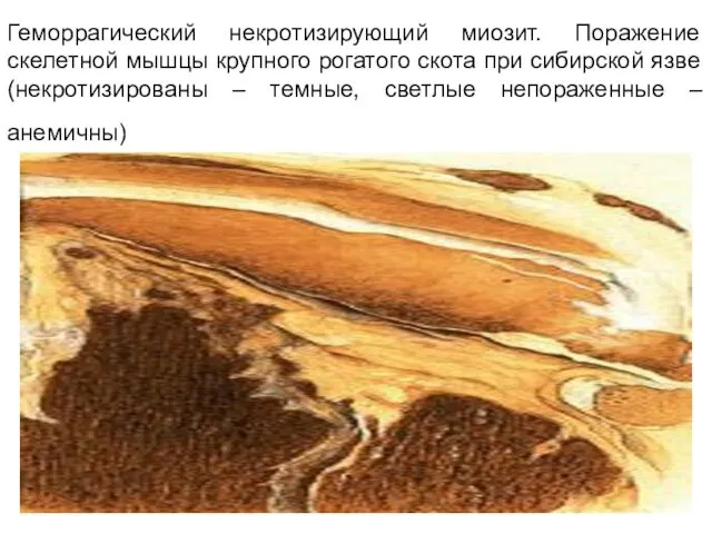 Геморрагический некротизирующий миозит. Поражение скелетной мышцы крупного рогатого скота при