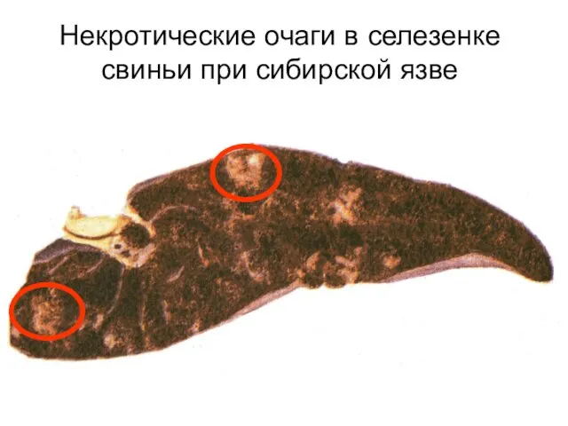 Некротические очаги в селезенке свиньи при сибирской язве