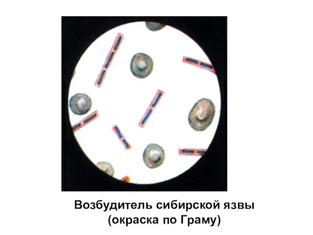 Возбудитель сибирской язвы (окраска по Граму)