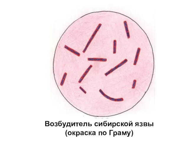 Возбудитель сибирской язвы (окраска по Граму)