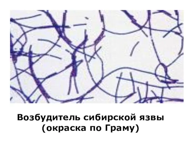 Возбудитель сибирской язвы (окраска по Граму)