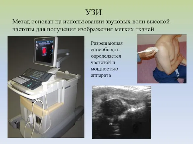 УЗИ Метод основан на использовании звуковых волн высокой частоты для