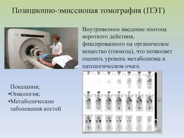 Позиционно-эмиссионая томография (ПЭТ) Внутривенное введение изотопа короткого действия, фиксированного на