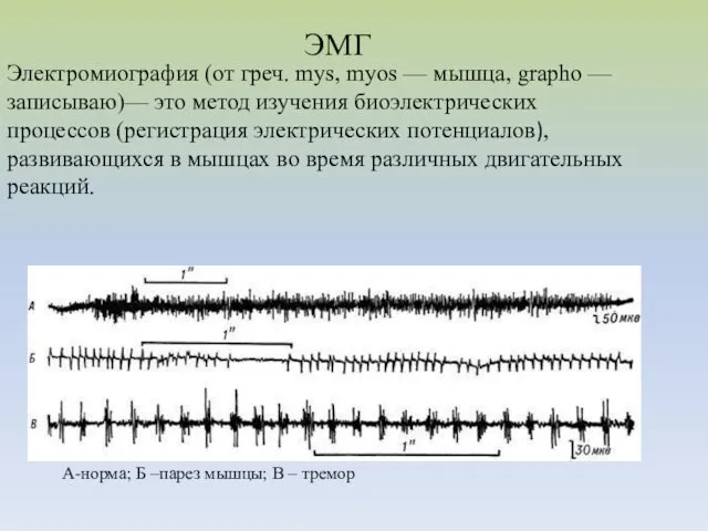 Электромиография (от греч. mys, myos — мышца, grapho — записываю)—