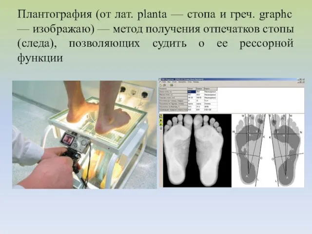 Плантография (от лат. planta — стопа и греч. graphc —