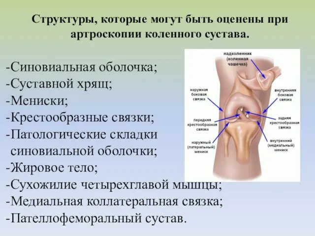 Структуры, которые могут быть оценены при артроскопии коленного сустава. Синовиальная