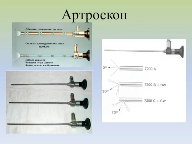 Артроскоп