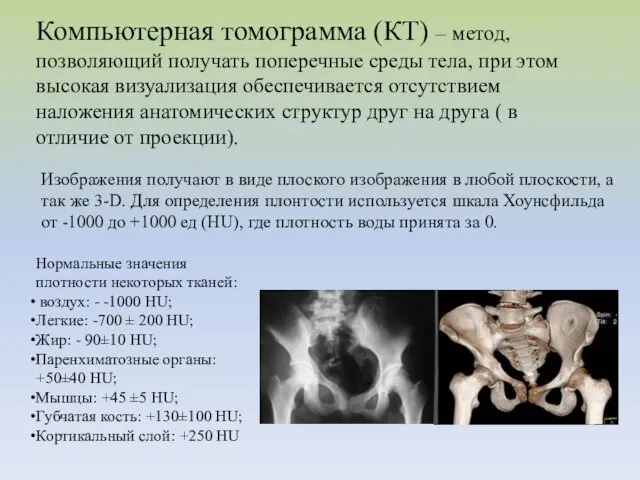 Компьютерная томограмма (КТ) – метод, позволяющий получать поперечные среды тела,