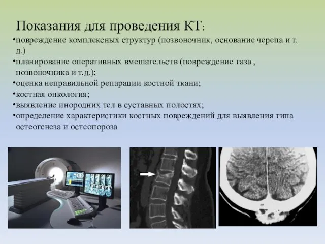 Показания для проведения КТ: повреждение комплексных структур (позвоночник, основание черепа