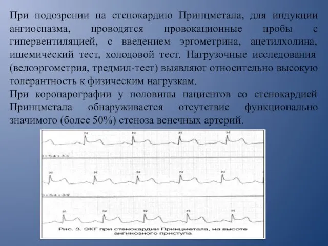 При подозрении на стенокардию Принцметала, для индукции ангиоспазма, проводятся провокационные