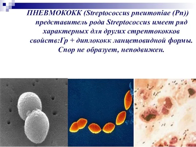 ПНЕВМОКОКК (Streptococcus pneumoniae (Рn)) представитель рода Streptococcus имеет ряд характерных для других стрептококков