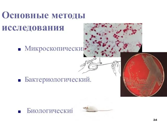 Основные методы исследования Микроскопический Бактериологический. Биологический.