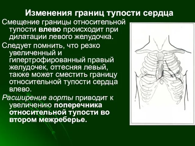 Изменения границ тупости сердца Смещение границы относительной тупости влево происходит