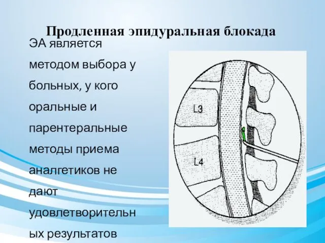 Продленная эпидуральная блокада ЭА является методом выбора у больных, у