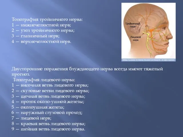 Топография тройничного нерва: 1 — нижнечелюстной нерв; 2 — узел
