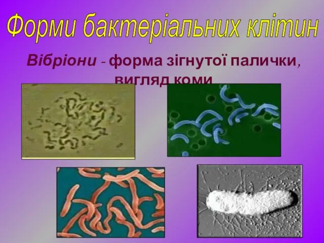 Форми бактеріальних клітин Вібріони - форма зігнутої палички, вигляд коми