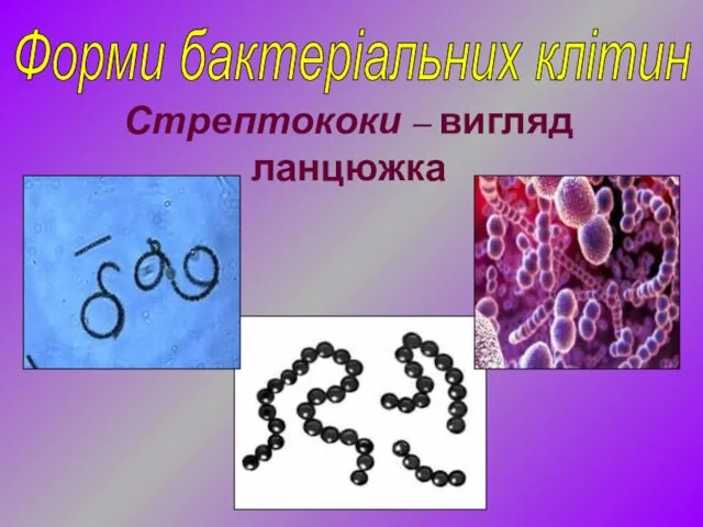 Форми бактеріальних клітин Стрептококи – вигляд ланцюжка