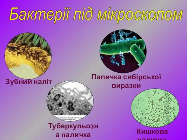 Кишкова паличка Бактерії під мікроскопом Зубний наліт Паличка сибірської виразки Туберкульозна паличка