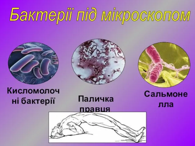 Сальмонелла Паличка правця Бактерії під мікроскопом Кисломолочні бактерії