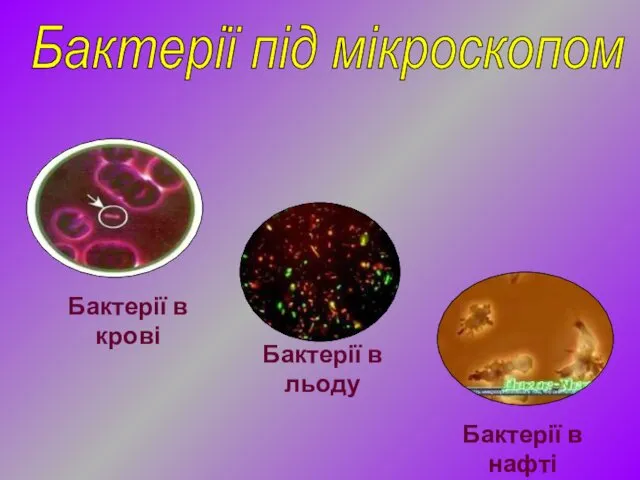 Бактерії під мікроскопом Бактерії в нафті Бактерії в крові Бактерії в льоду