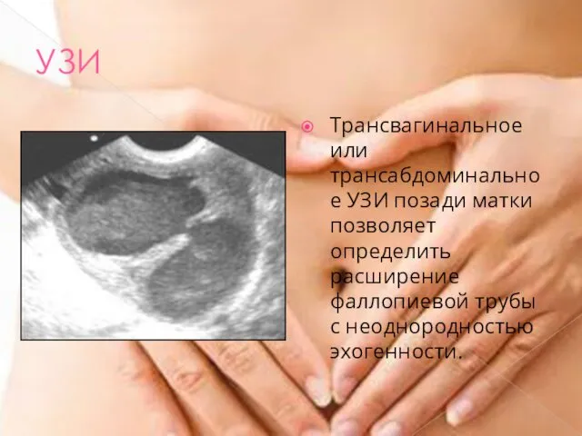 УЗИ Трансвагинальное или трансабдоминальное УЗИ позади матки позволяет определить расширение фаллопиевой трубы с неоднородностью эхогенности.