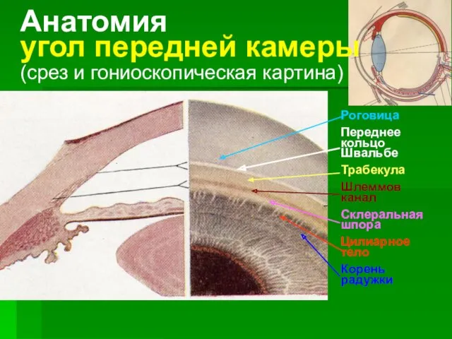 Анатомия угол передней камеры (срез и гониоскопическая картина) Роговица Переднее кольцо Швальбе Трабекула