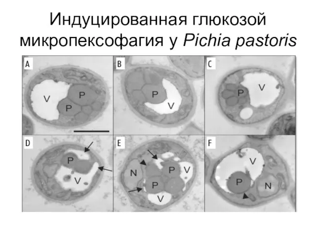 Индуцированная глюкозой микропексофагия у Pichia pastoris